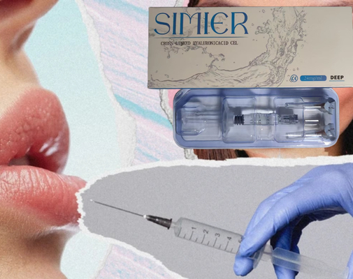 SIMIER ২ মিলি এন্টি-উইলস ফেসিয়াল ইনজেকশনাল হাইয়ালুরোনিক এসিড ডার্মাল ফিলার