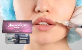 ত্বকের জন্য ফিলার Juvederm Ultra 4 Hyaluronic Acid Injections for Lips 2*1ml