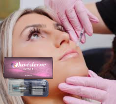 Juvederm Ultra 3 ইনজেকশনযোগ্য ত্বকের ফিলার হাইয়ালুরোনিক অ্যাসিড ফেস ইনজেকশন 2*1ml