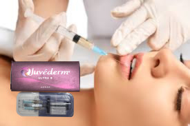 মুখ, নাক হাইয়ালুরোনিক অ্যাসিড ঠোঁট ফিলার Juvederm Ultra 4 24mg/Ml