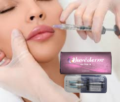 2 X 1 মিলি Juvederm Ultra 4 ইনজেকশনযোগ্য ত্বকের ফিলার ঠোঁটের ফিলার ইনজেকশন
