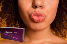 ঠোঁট বাড়ানোর জন্য Juvederm Ultra 3 Ultra 4 Hyaluronic Acid Filler