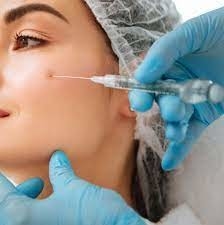 মসৃণ wrinkles ইনজেকশনযোগ্য ত্বকের ফিলার হাইয়ালুরোনিক এসিড Juvederm Ultra 3 2*1ml